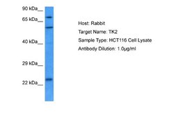 Thymidine Kinase 2 Rabbit anti-Human, Polyclonal, Novus Biologicals 0.1 mL | Buy Online | Novus Biologicals | Fisher Scientific